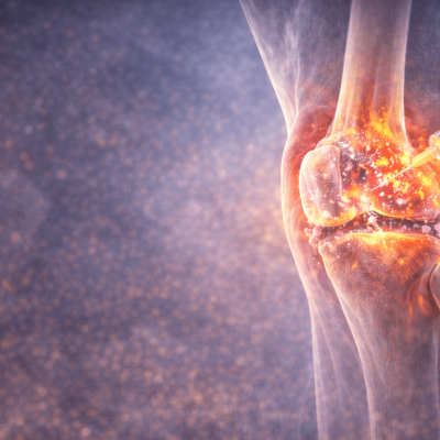 Akıllı Plazma Tedavisi (ACRS) Nedir?