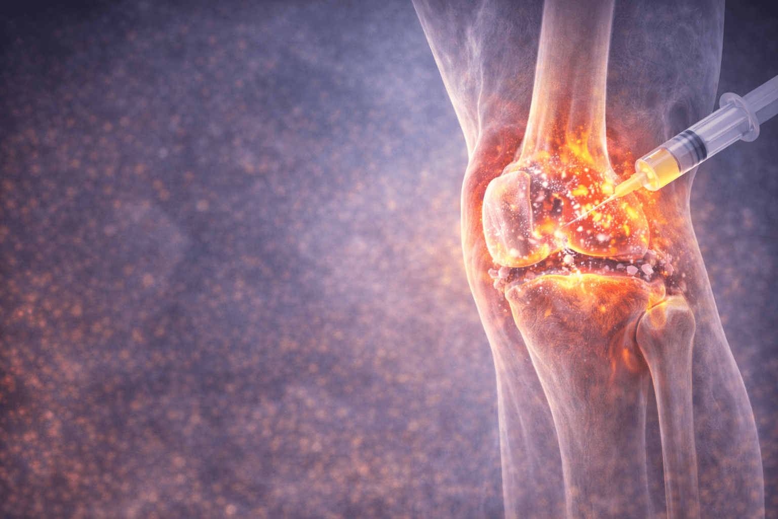 Akıllı Plazma Tedavisi (ACRS) Nedir?